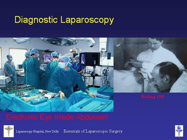 Laparoscopic Pictures From World Laparoscopy Hospital