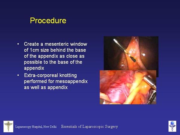 Laparoscopic Pictures From World Laparoscopy Hospital