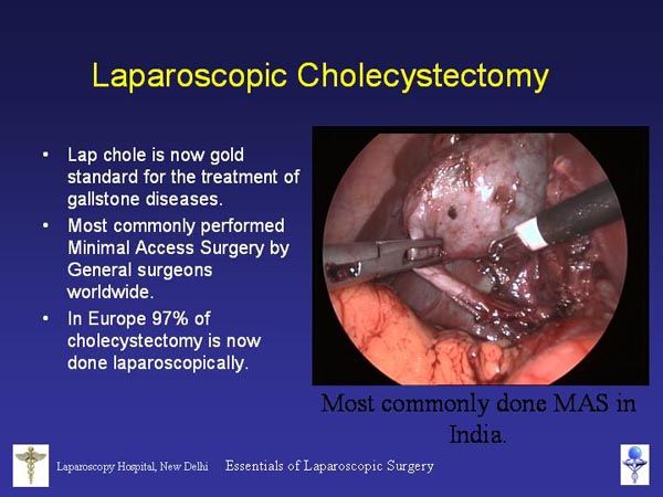 Laparoscopic Pictures From World Laparoscopy Hospital