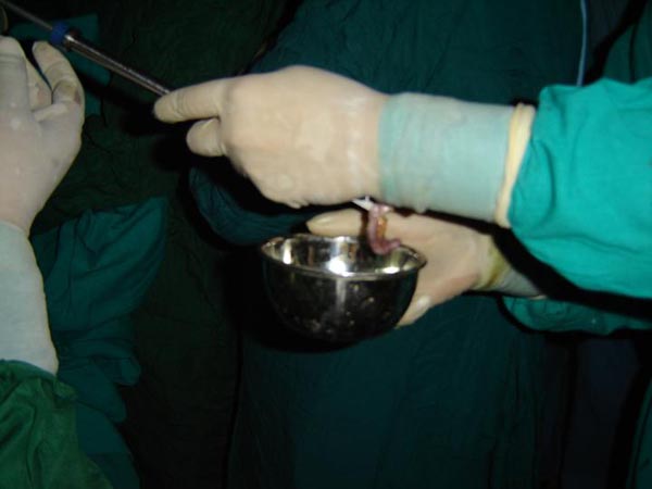 Laparoscopic Pictures From World Laparoscopy Hospital