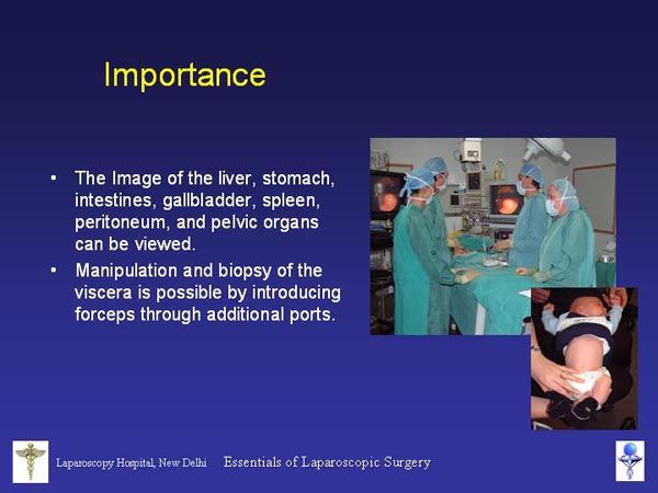 Laparoscopic Pictures From World Laparoscopy Hospital