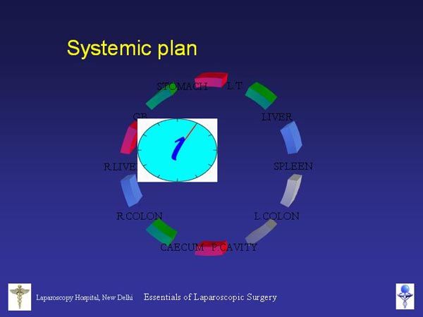 Laparoscopic Pictures From World Laparoscopy Hospital
