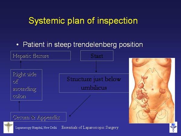 Laparoscopic Pictures From World Laparoscopy Hospital