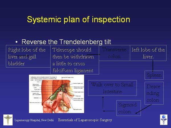 Laparoscopic Pictures From World Laparoscopy Hospital