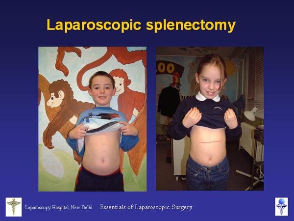 Laparoscopic Pictures From World Laparoscopy Hospital