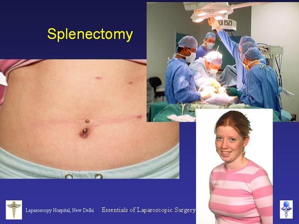 Laparoscopic Pictures From World Laparoscopy Hospital