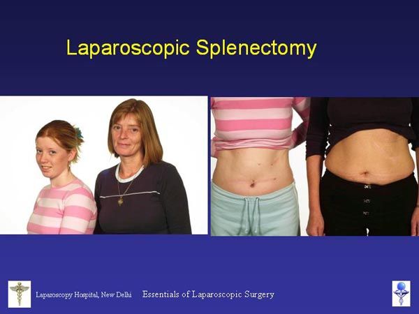 Laparoscopic Pictures From World Laparoscopy Hospital