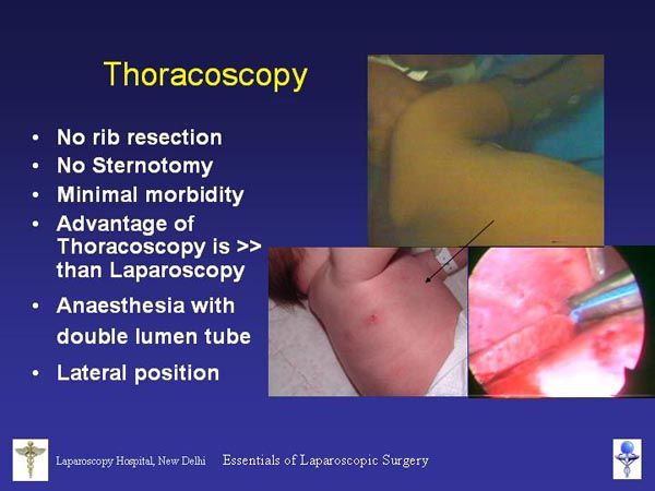 Laparoscopic Pictures From World Laparoscopy Hospital