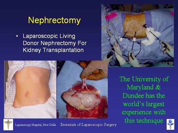 Laparoscopic Pictures From World Laparoscopy Hospital