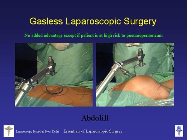 Laparoscopic Pictures From World Laparoscopy Hospital