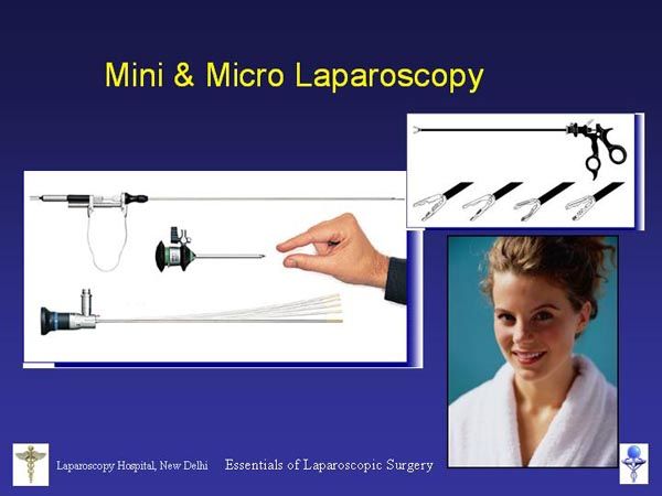 Laparoscopic Pictures From World Laparoscopy Hospital
