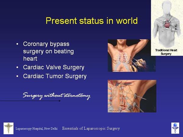 Laparoscopic Pictures From World Laparoscopy Hospital