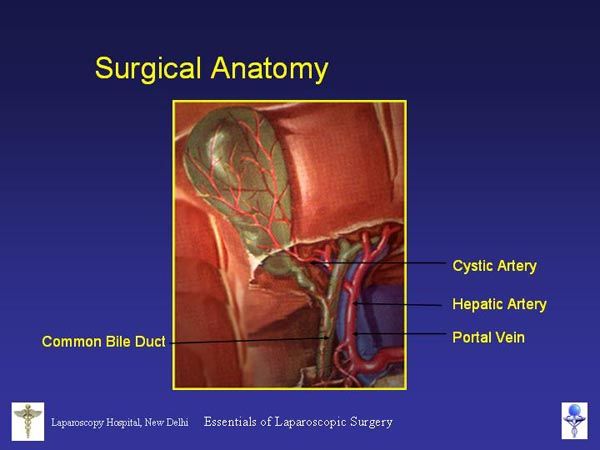 Laparoscopic Pictures From World Laparoscopy Hospital