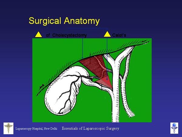 Laparoscopic Pictures From World Laparoscopy Hospital