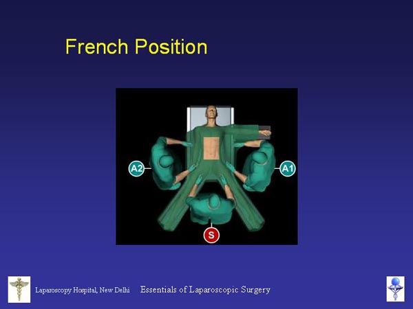 Laparoscopic Pictures From World Laparoscopy Hospital