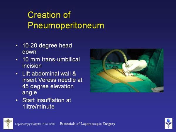 Laparoscopic Pictures From World Laparoscopy Hospital