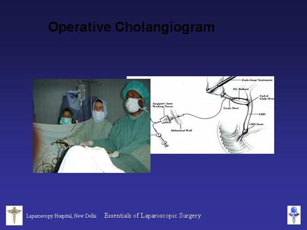 Laparoscopic Pictures From World Laparoscopy Hospital