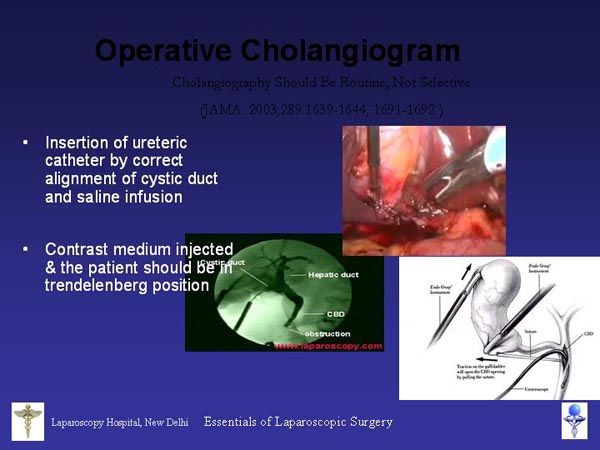 Laparoscopic Pictures From World Laparoscopy Hospital