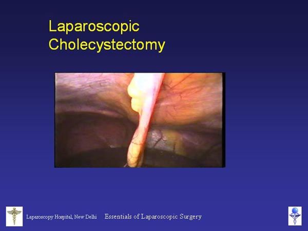 Laparoscopic Pictures From World Laparoscopy Hospital