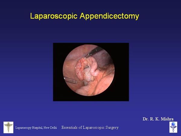 Laparoscopic Pictures From World Laparoscopy Hospital