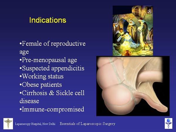 Laparoscopic Pictures From World Laparoscopy Hospital