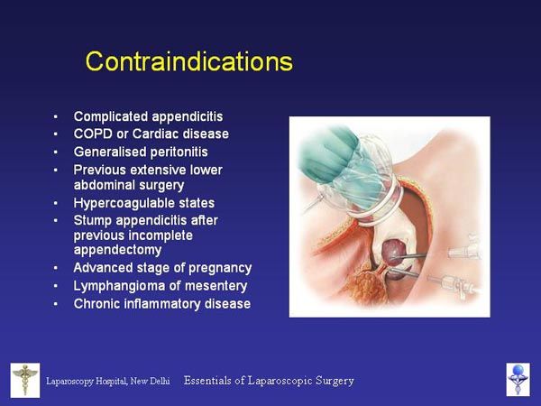 Laparoscopic Pictures From World Laparoscopy Hospital