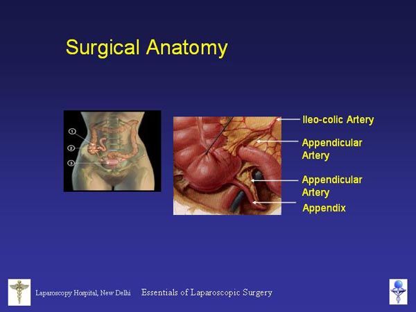 Laparoscopic Pictures From World Laparoscopy Hospital