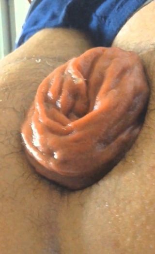 Discharge from male dogs anus