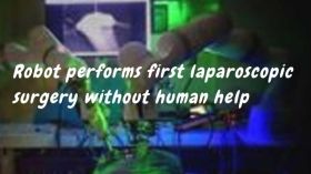 Robot performs first laparoscopic surgery without doctor's help