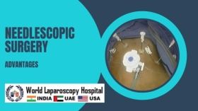Advantages of Needlescopic surgery