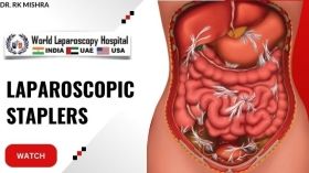 Laparoscopic staplers market is experiencing strong growth