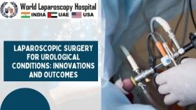 Laparoscopic Surgery for Urological Conditions: Innovations and Outcomes