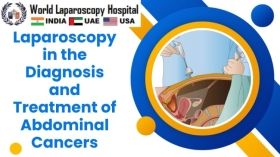 Laparoscopy in the Diagnosis and Treatment of Abdominal Cancers
