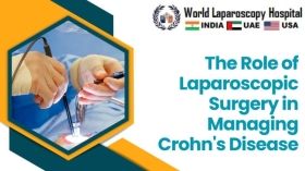 The Role of Laparoscopic Surgery in Managing Crohn's Disease