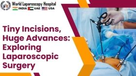 Tiny Incisions, Huge Advances: Exploring Laparoscopic Surgery