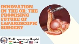 Innovation in the OR: The Promising Future of Laparoscopic Surgery