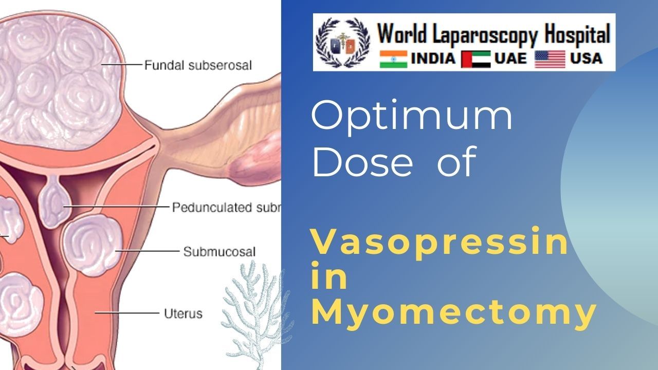 Laparoscopic Myomectomy