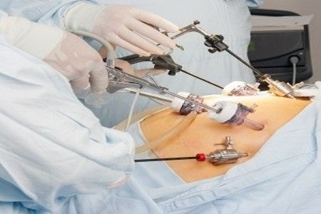 Laparoscopic Surgeons