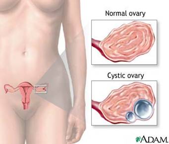 Anatomy of Ovary