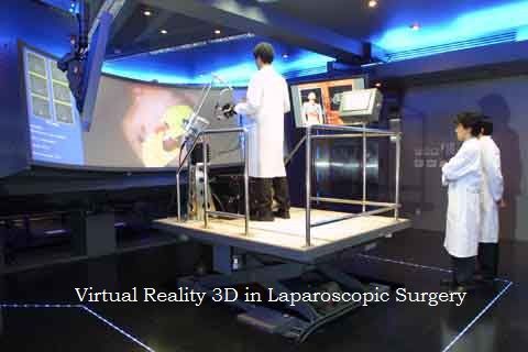 3D in Laparoscopic Surgery