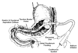 Gastrostomy Tube