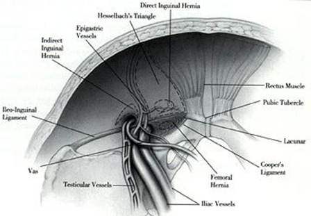 Inguinal Hernia Surgical Anatomy