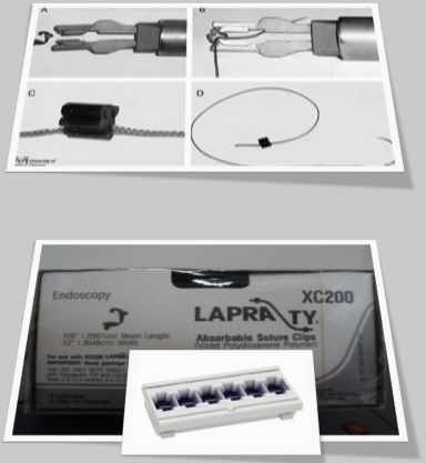 LAPRA-TY® Absorbable Suture Applier