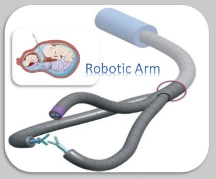 Minirobotic arm