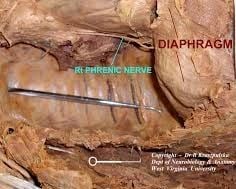 Shoulder Pain After Laparoscopy