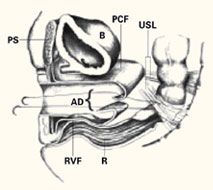 Ischial Spine