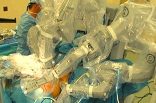 da Vinci Prostectomy