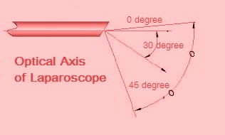 30 Degree Laparoscope