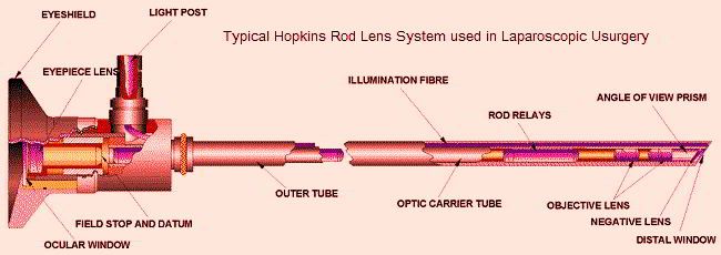 Laparoscope used in Laparoscopic Surgery