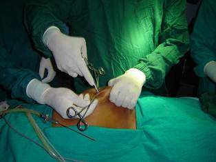 Microlaparoscopic Surgery